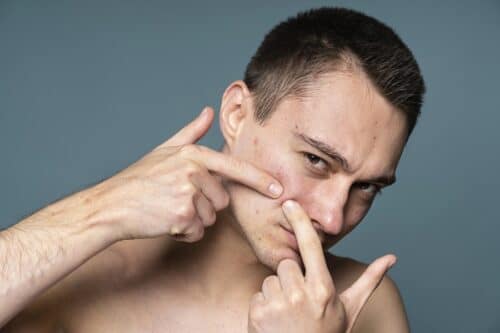 uomo che schiaccia un brufolo